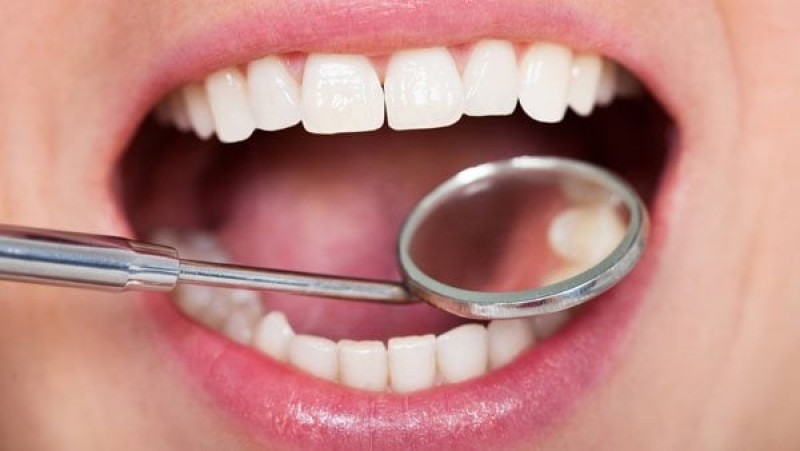 أبرز أسباب تسوس أسنان الأطفال